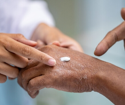 Creams Skin Cancers & Melanomas - 10