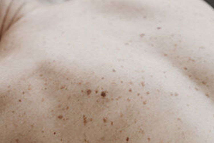 TSC Waiting room 1 1 Summer is officially here - time for a skin check! - 1