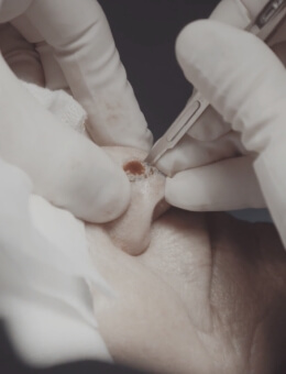 grid1 Skin Cancers & Melanomas - 16