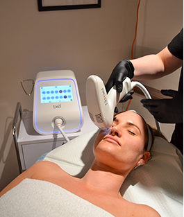 Tixel Skin Rejuventation Treatment