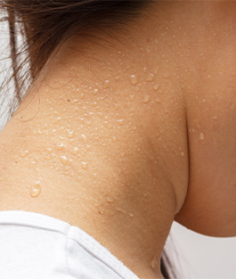 Excessive Sweating Treatments