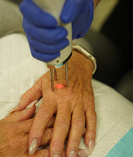 Tattoo Removal