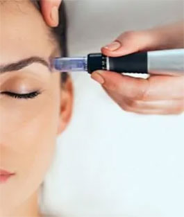 RF Microneedling 1 RF MICRONEEDLING RF Microneedling - 1